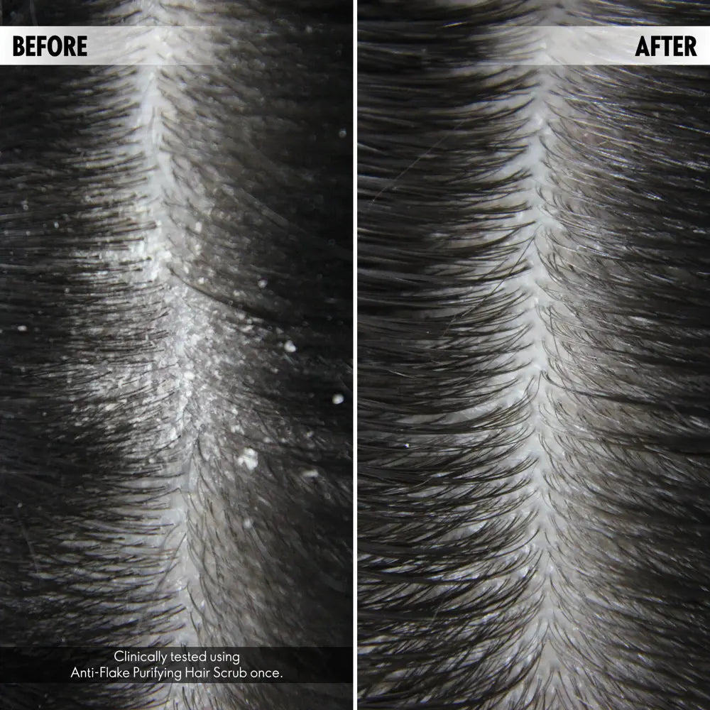 Duologi Anti-Flake Purifying Scalp Scrub