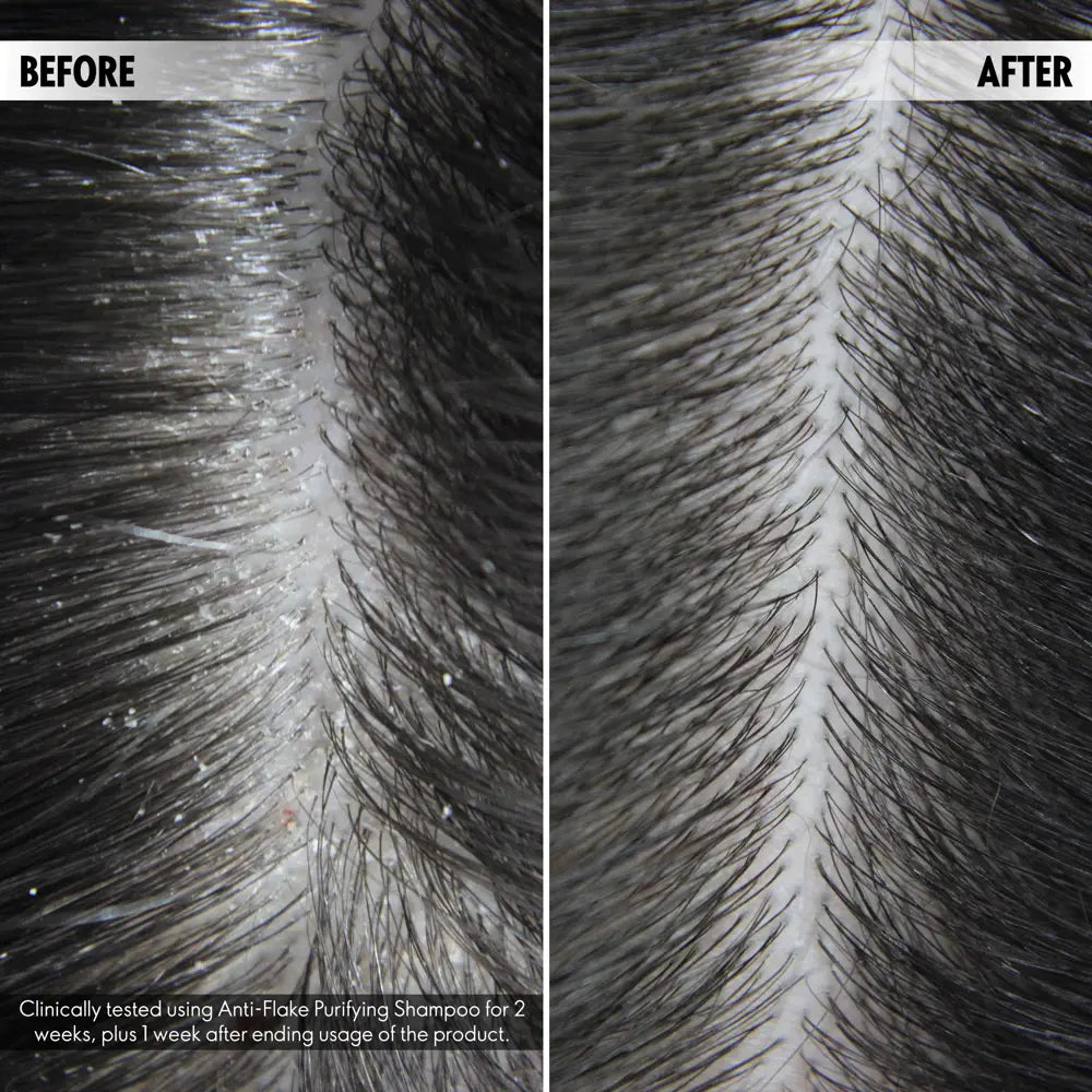 Duologi Anti-Flake Purifying Shampoo