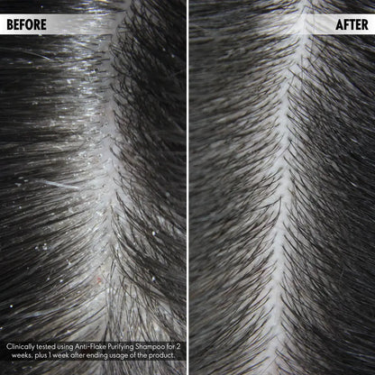 Duologi Anti-Flake Purifying Shampoo
